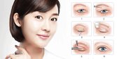 Nhấn mí vi sợi collagen